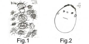 Before-and-After