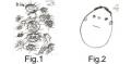 Alternative treatment for ADD/ADHD (Attention Deficit Disorder & Hyperactivity Disorder)