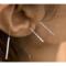 Quit-Smoking-Acupuncture