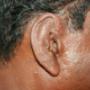 Silicone Ear