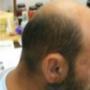Silicone Ear