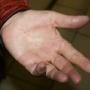 Silicone Index Finger, After