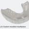 Moulded SnoreMeds anti-snoring mouthpiece