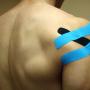 Strapping