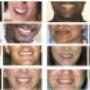 Befores and Afters Cosmetic DEntist Dr J Nunes