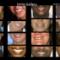 Dental-Crown-is-R4000-inc