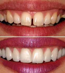 Dental-Emergencies