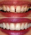 Guidelines and Instructions on Common dental Emergencies