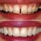 Dental-Emergencies
