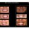 Dental-Implants-Price