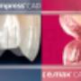 Ivoclar Ceramics