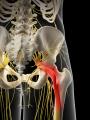 Diagnose Nerve Pain