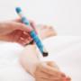 Moxibustion