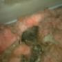 Dead rat in the roof