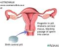 Womb Cleaning