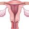 Womb-Cleaning