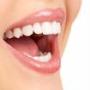 Porcelain Veneers