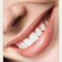 Smile Make-over