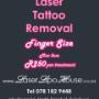 Tattoo Removal