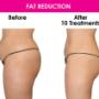 Fat reduction