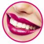 Teeth Whitening