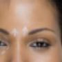 Botox Treatments