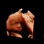 vinno 4D ultrasound machines