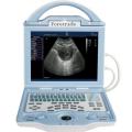 FT500 Ultrasound machine