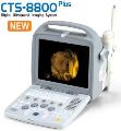 Portable-4D-ultrasound