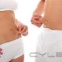 Uploaded by visitor on 2016/01/25 - Non-Surgical Ultrasound Liposuction