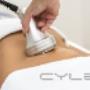Uploaded by visitor on 2016/01/25 - Non-Surgical Ultrasound Liposuction