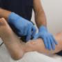 Laser Therapy