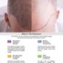 The Hairfront