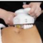 I-Lipo Ultra