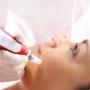 Microneedling Treatment