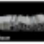 Aluminium Profiles