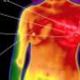 Thermography