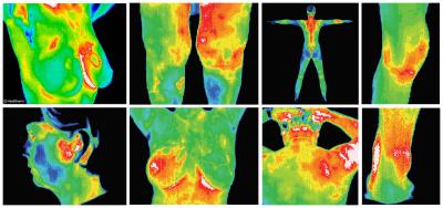 Thermography