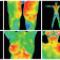 Thermography
