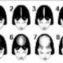 Stages of hairloss