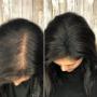 Before and After Photo