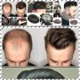 Men Hair Replacement Pieces