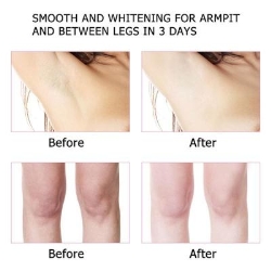 Skin Lightening,Hips And Bums Creams ,Penis Enlargement Herbal Products +27780597608