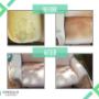 Before & After 3