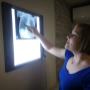 Dr. Roux examining X-Ray