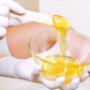 Sugar wax hair removal