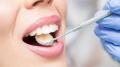 Minor oral surgery