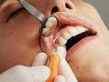 Dental checkups and teeth cleaning