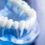 Prosthetic Dentistry