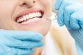 Teeth Whitening